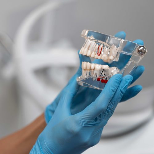 close-up-dentist-instruments (1) (1) (1)